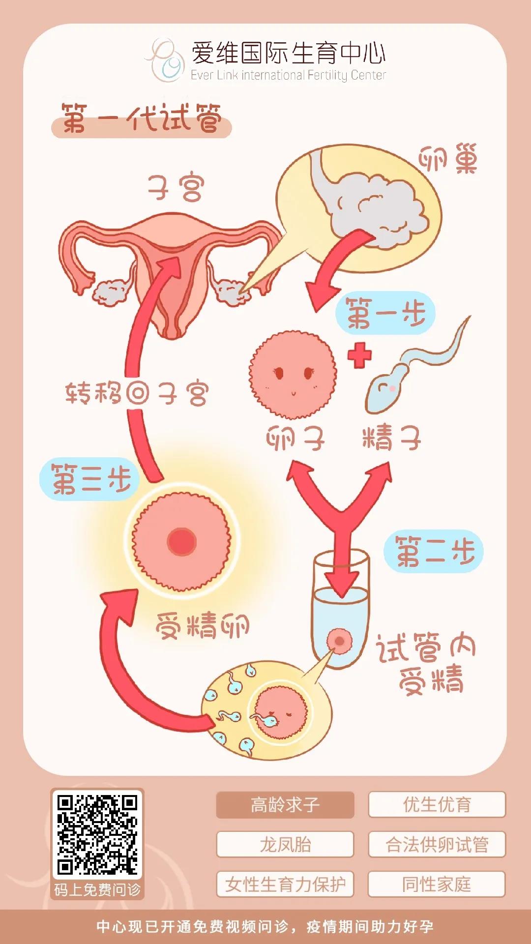 供卵试管婴儿取卵要多长时间